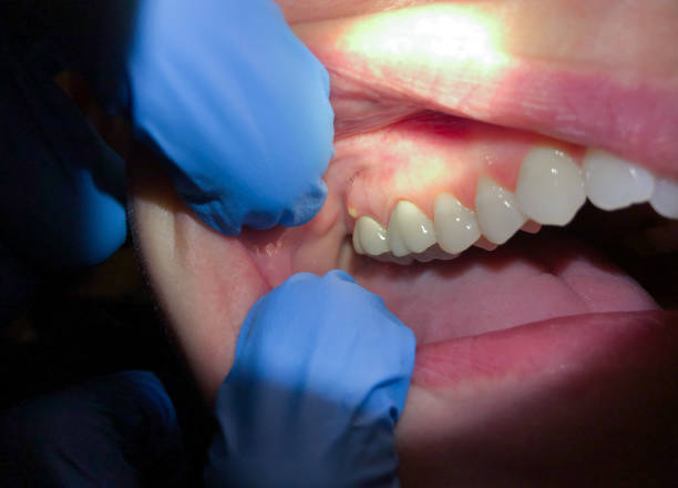 Best Pediatric Emergency Dentist in Maysville, KY